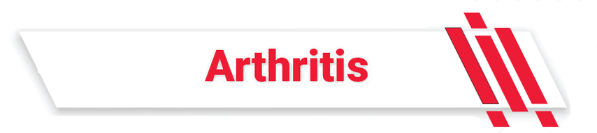 ns_treat_arthritis
